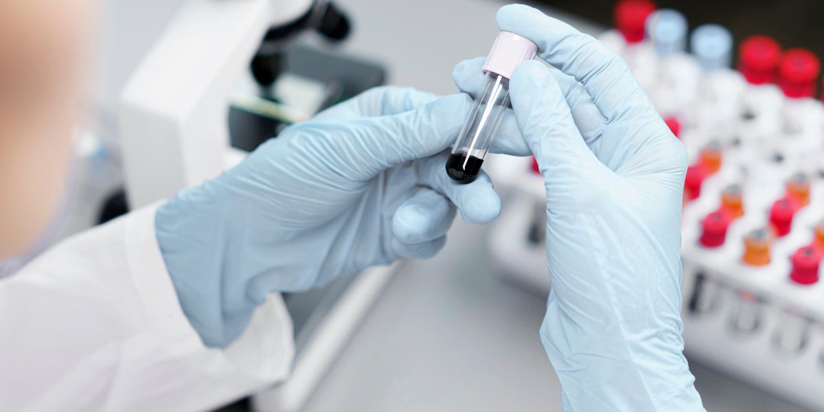 Lečenje HIV inflekcije uz pomoć matičnih ćelija